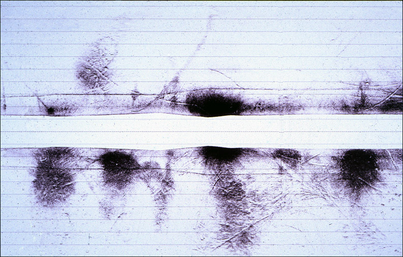 sidescan sonar image of circular dredge spoils