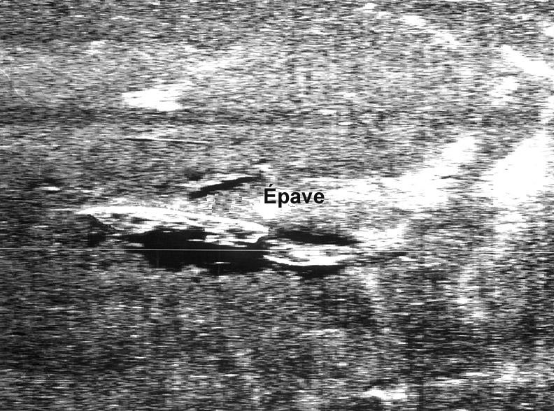 Levé de sonar à balayage latéral d’une zone de The Narrows